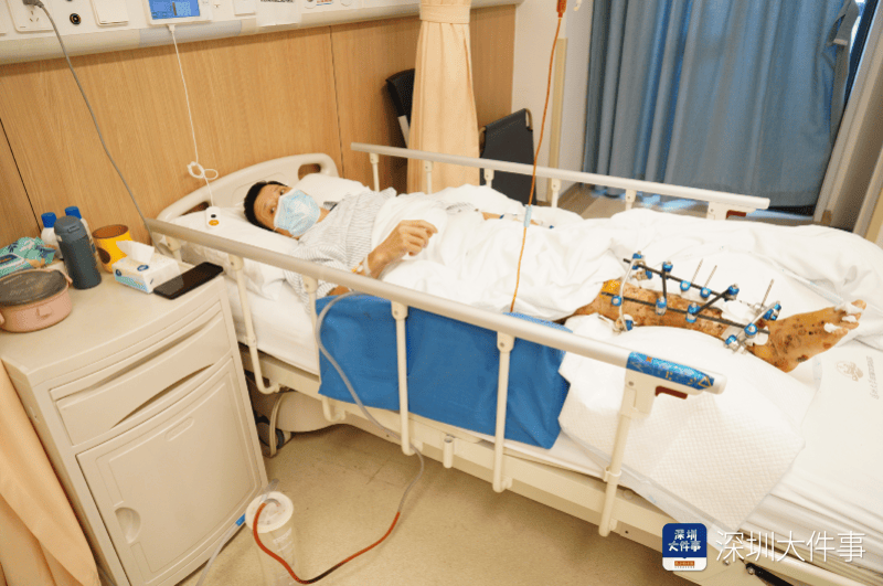 失血过半！深圳男子被三四百斤模具砸到<strong></p>
<p>朝币换算</strong>，医生全力抢救