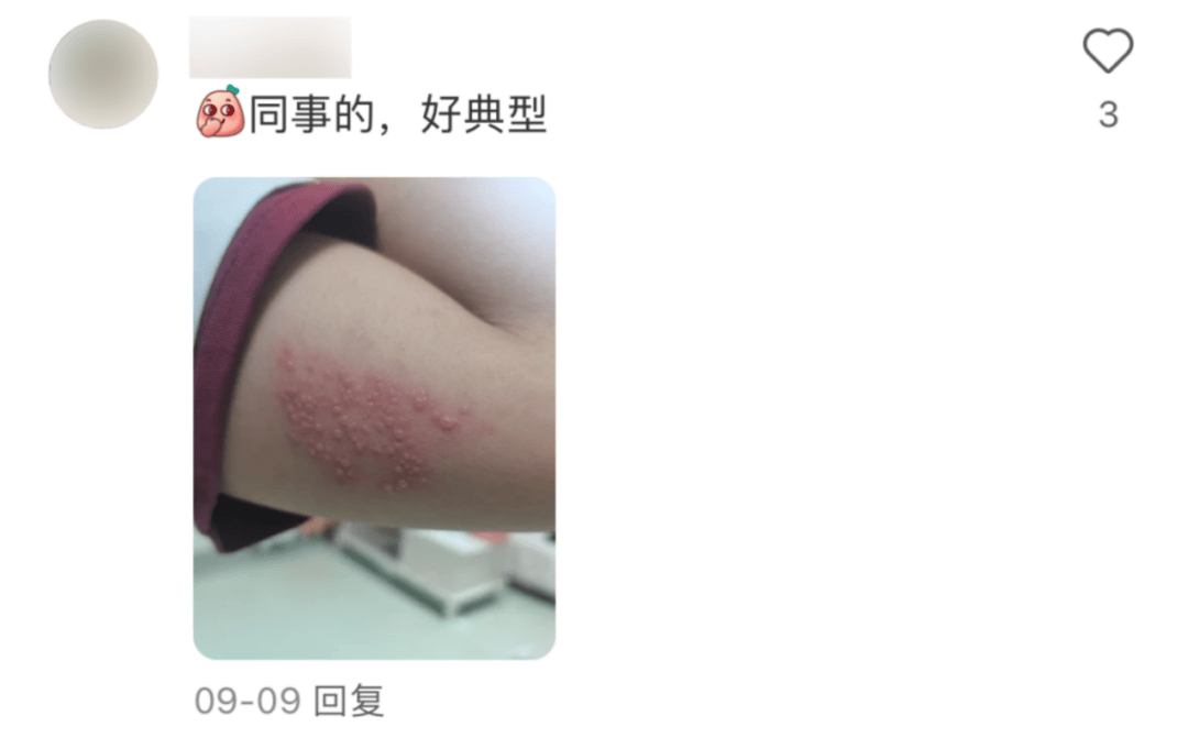 一旦感染终身携带<strong></p>
<p>全球交易货币</strong>！深圳疾控提醒：这4类人要注意