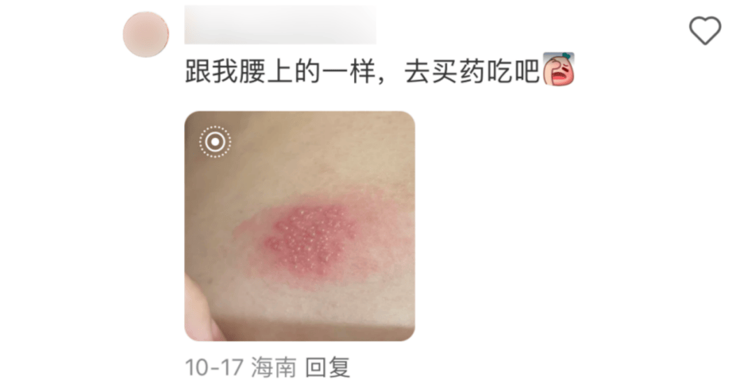 一旦感染终身携带<strong></p>
<p>全球交易货币</strong>！深圳疾控提醒：这4类人要注意