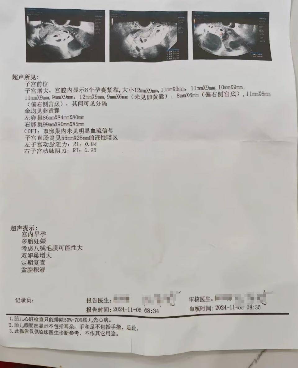 怀上9胞胎女子今日进行减胎手术：分两次进行<strong></p>
<p>全球交易货币</strong>，第一次减去四个胚胎，第二次减去三个