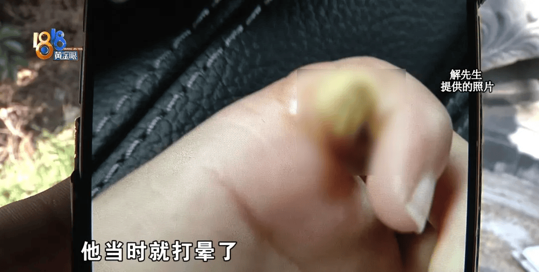 5岁男童瞬间晕厥<strong></p>
<p>货币投机家</strong>，筋都断了！街上常见，看见立即远离