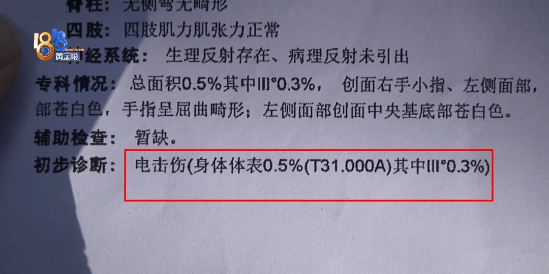 5岁男童瞬间晕厥<strong></p>
<p>货币投机家</strong>，筋都断了！街上常见，看见立即远离