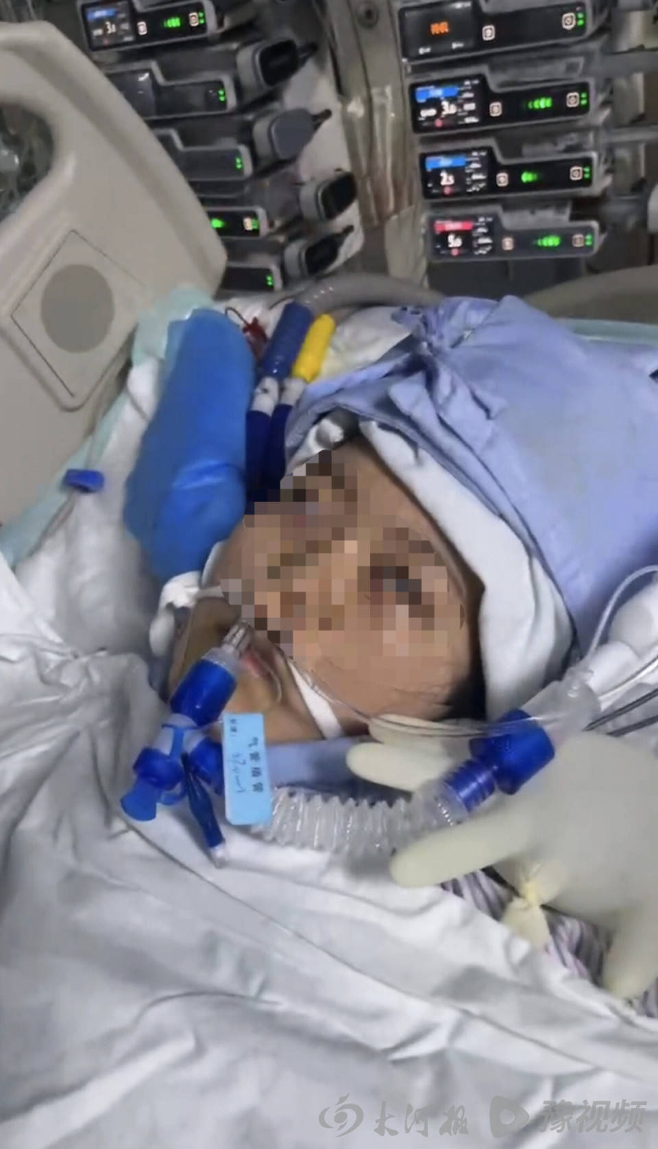 22岁美甲师手术成功却在复苏室脑死亡<strong></p>
<p>数字货币app</strong>，家属称缺氧30分钟监护医生未察觉，医院回应