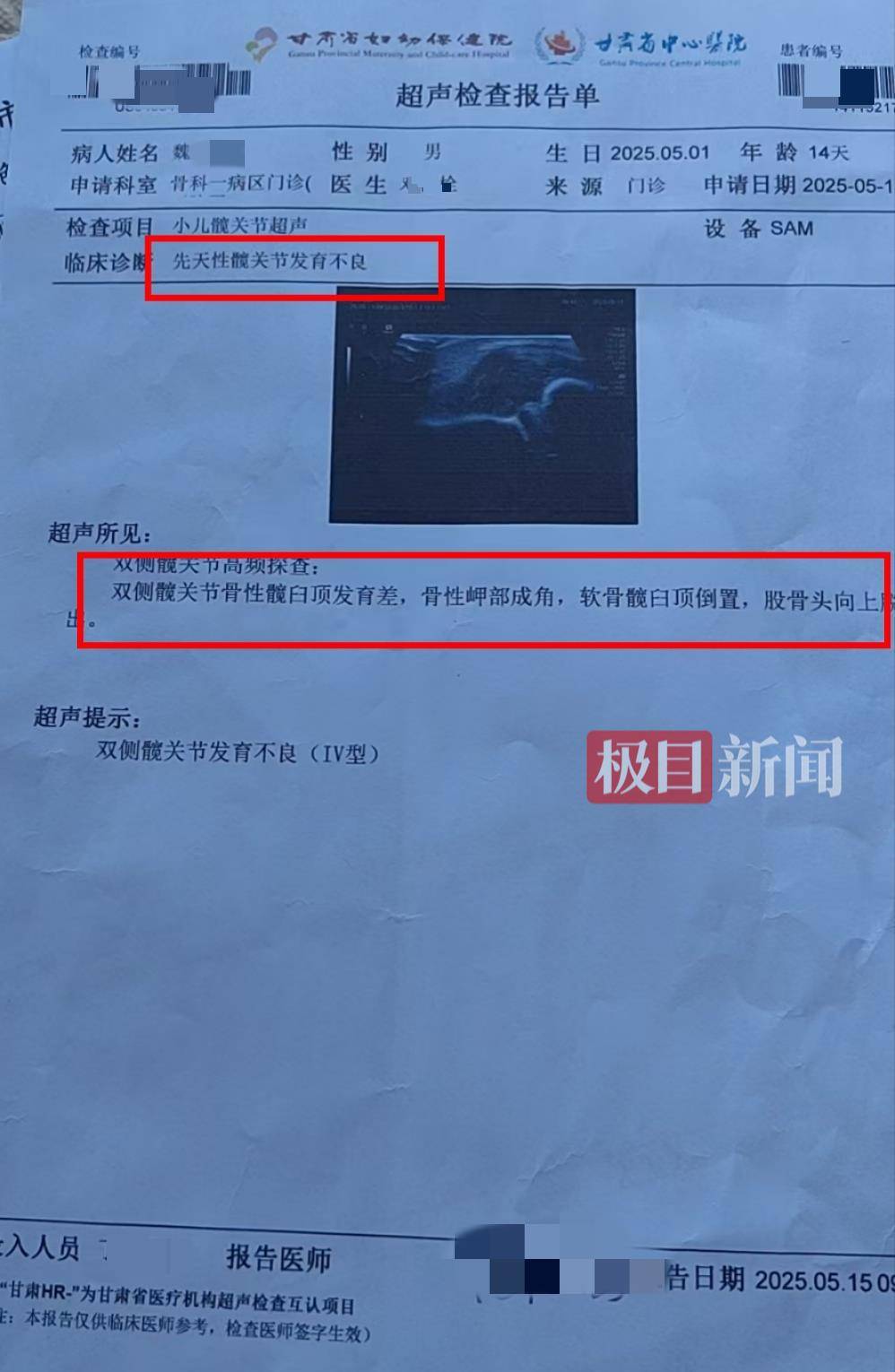 二胎出生查出先天性病症或落下残疾<strong></p>
<p>以太坊最新价格</strong>，残疾父母称医院产检漏检、未尽告知义务，医院及医调委回应