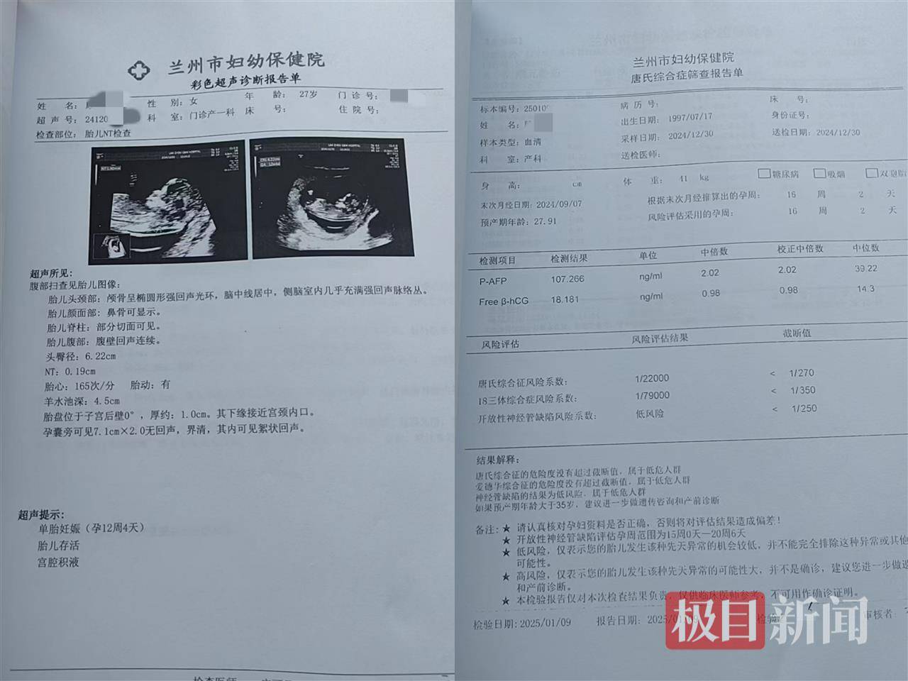 二胎出生查出先天性病症或落下残疾<strong></p>
<p>以太坊最新价格</strong>，残疾父母称医院产检漏检、未尽告知义务，医院及医调委回应