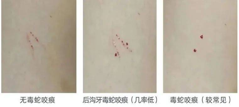 惊恐！毒蛇缠在自行车上<strong></p>
<p>USDa</strong>，深圳13岁男孩伸手被咬！近期超80人中招