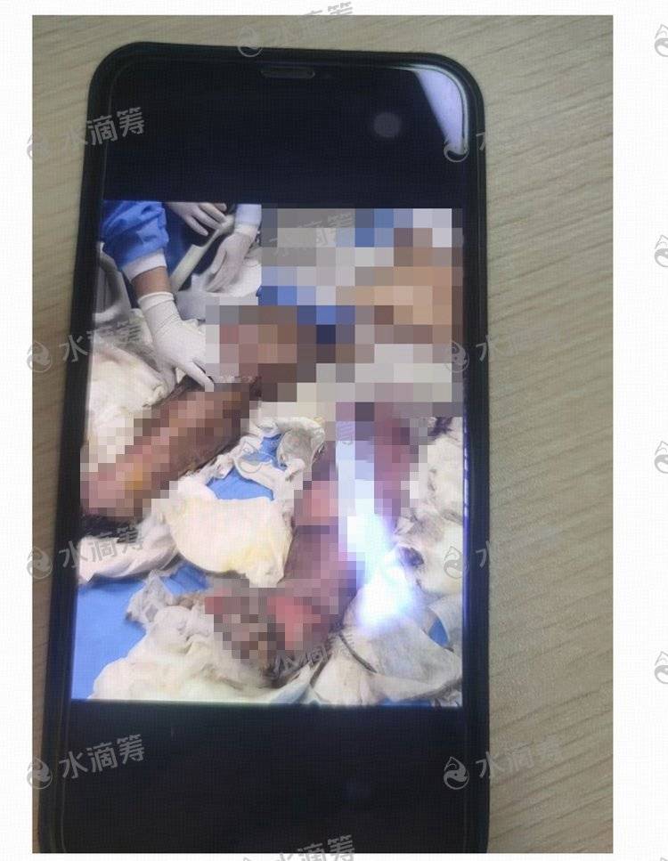 成都一小区电瓶车楼道“飞线充电”酿火灾<strong></p>
<p>泰达币</strong>，一家四口1死2伤，涉事车主被刑拘