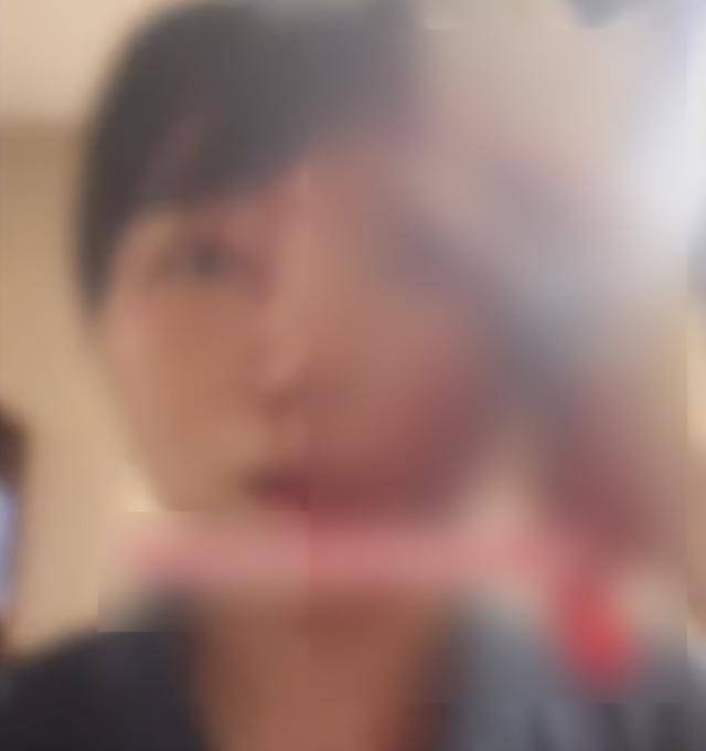 缝了20多针！女子称被不知名男同事砸头毁容<strong></p>
<p>比特现金交易</strong>，警方介入