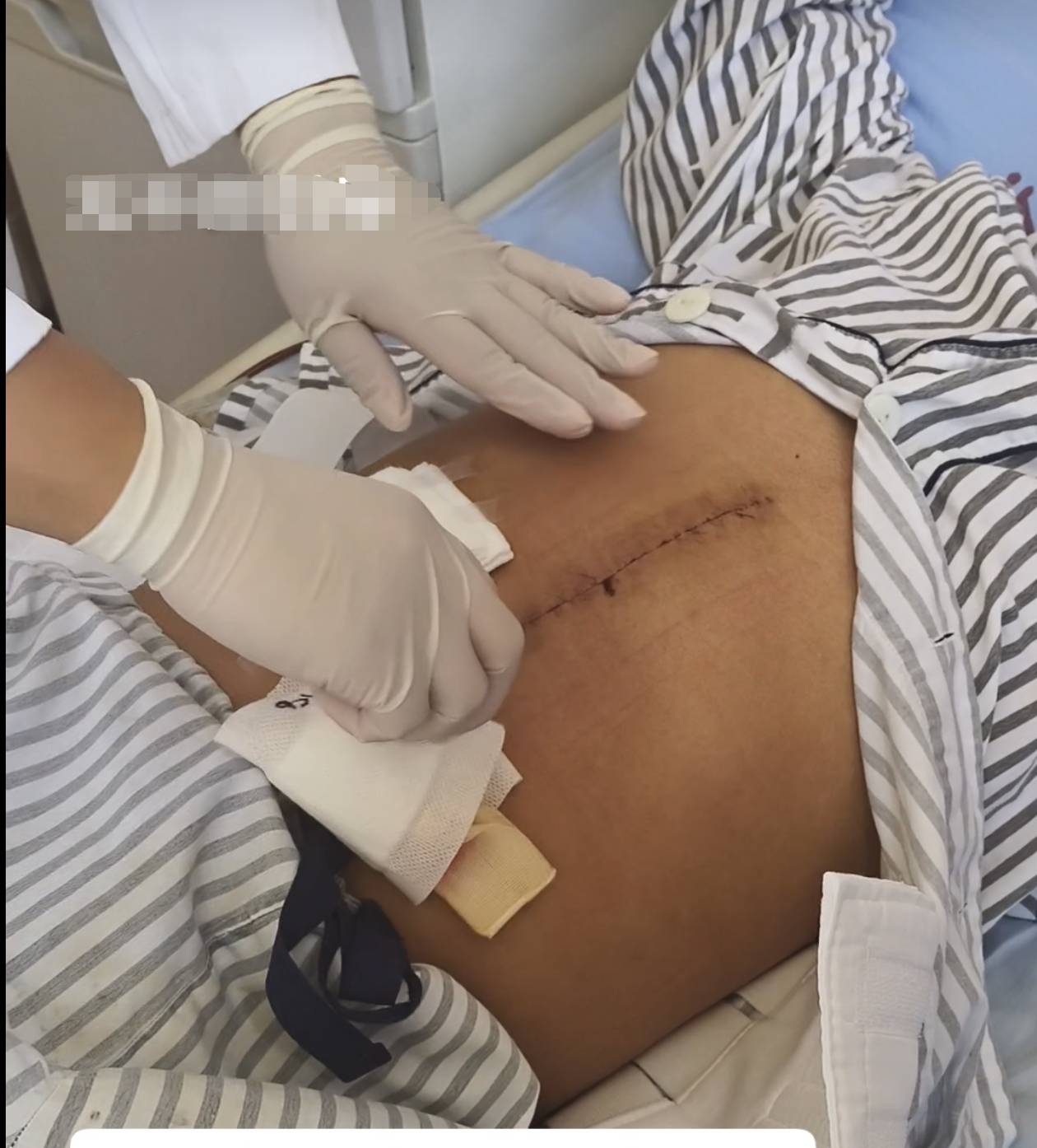 奶奶在哭<strong></p>
<p>LTC交易</strong>，宝宝在笑！40天女婴重病，00后父亲割肝救女，术后这一幕让网友泪奔