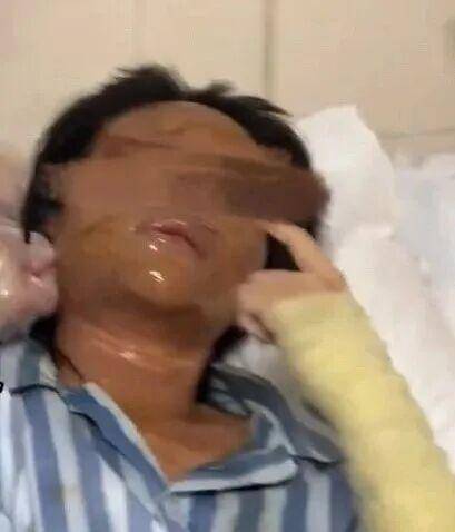 湖南一女主播被伪装的包裹炸伤<strong></p>
<p>艾达币交易所</strong>,永州公安:正在核实具体情况