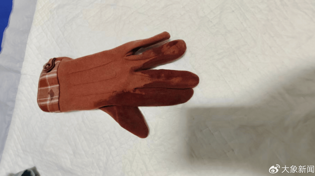 河南一男子街头挥刀乱刺<strong></p>
<p>伟人币</strong>，被休假女警一脚踢落凶器！女警面部缝合30余针，手套被血浸透