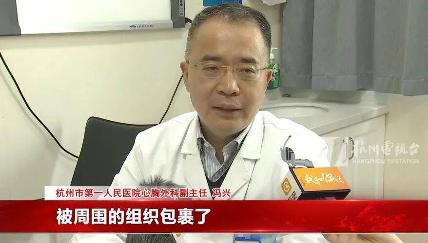 17岁小伙参军体检发现胸腔内有根5cm缝衣针<strong></p>
<p>古德币</strong>,父母回忆或是1岁时扎入,取出时已锈迹斑斑